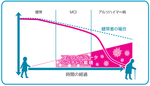 アミロイドベータペプチドの蓄積 アミロイドベータペプチドの蓄積